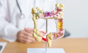 Bác sĩ Anh cảnh báo kiểu ăn khiến nhiều người trẻ ung thư Bác sĩ Anh cảnh báo kiểu ăn khiến nhiều người trẻ ung thư