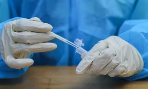 9 người tử vong liên quan đậu mùa khỉ 9 người tử vong liên quan đậu mùa khỉ